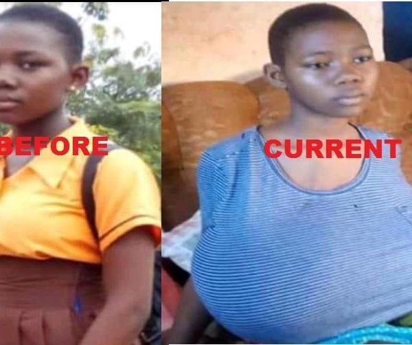 This JHS3 student is suffering