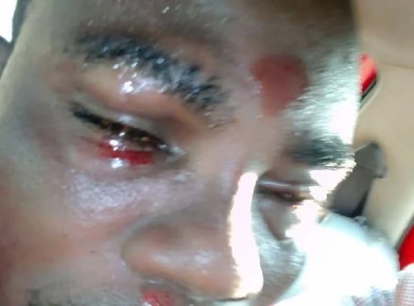 Parliamentary contest turns bloody in Fomena Constituency