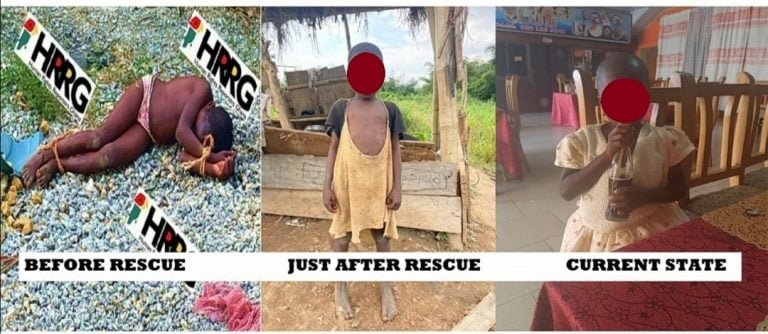Human Rights Reporters Ghana gets results: 7-year-old girl brutally assaulted, tortured by father rescued